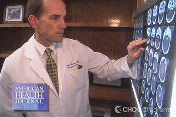 Dr. Michael Muhonen - Dermoid Cysts