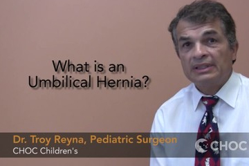 Dr. Troy Reyna - Umbilical Hernia