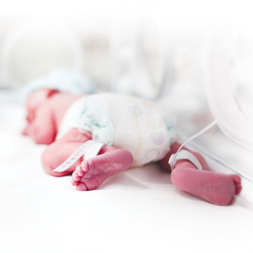 Preemie baby in the NICU