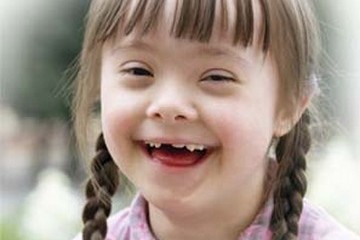 Girl with down syndrome smiling