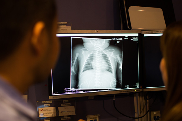 Technician looking at chest x-ray