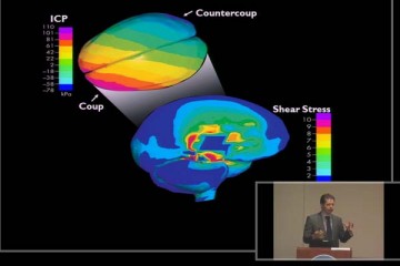 Behind concussions