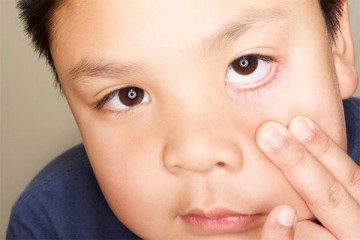 Young boy showing his eye