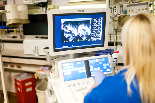 prenatal testing ultrasound