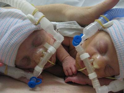 Two preemie babies