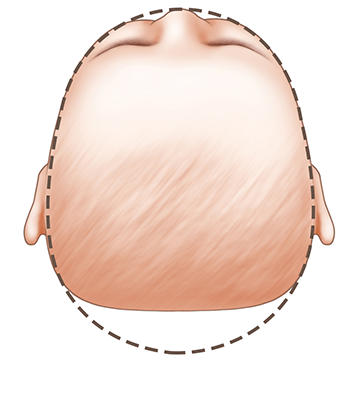 Baby has flat spot on side of head cheap