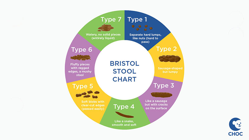Bristol Stool Chart, showing range of poop textures from hard and lumpy to watery