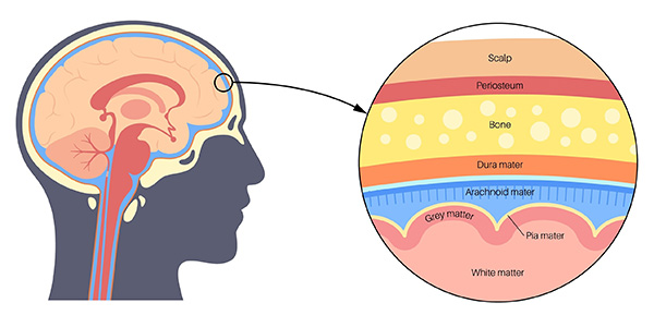 Diagram of a human brain showing the arachnoid membrane